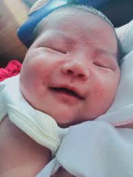 white spot Hello po mommies ano po pwd igamot sa parang kama