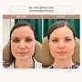 Profile Picture of Allison Gordon, FNP-BC (@allison_aesthetic_np) - Instagram (@instagram.com) on Google