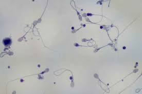 If one ejaculates 10 milliliters, he will need to replace 100 times that in blood. Semen Facts The Mix