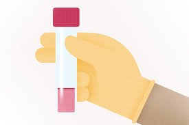 Most inherited cases of breast cancer are associated with mutations in two genes: What To Do If You Ve Tested Positive National Breast Cancer Foundation