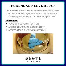 Image result for Pudendal Block