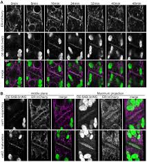 In plant cytokinesis cell plate grows. Sabre Populates Er Domains Essential For Cell Plate Maturation And Cell Expansion Influencing Cell And Tissue Patterning Elife