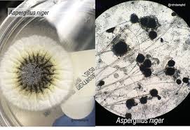 Aspergillus niger est largement répandu (fruits et légumes moisis, fourrage, produits laitiers, semences de maïs). Aspergillus Niger On Culture And Microscopy Rich Davis Grepmed