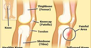 Pin On Health