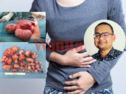 Cara diet perut buncit harus anda coba untuk mendapatkan perut yang kembali rata. Perut Buncit Senggugut Teruk Kerap Terkencing Susah Mengandung Simptom Wanita Mungkin Ada Fibroid Mingguan Wanita