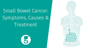 However, this survival rate drops significantly the longer a person has the disease before diagnosis. Small Bowel Cancer Gi Cancer