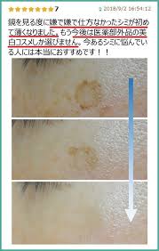 爆売れ中 今あるシミを消したい人 専用 厚生労働省が効果を認める 医薬部外品コスメ が凄すぎ mycosme シミ消し シミ しみ 消す