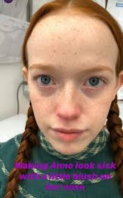 Pin de Charlie Zimmerman em Freckles