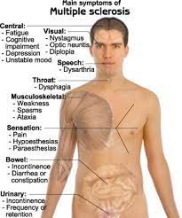 Multiple sclerosis can cause a variety of symptoms: Multiple Sclerosisnursing File Nursing File
