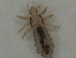 Check spelling or type a new query. Head Lice Dermnet Nz