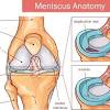 In this article, we will go deep into the functionality of acls, and. 1