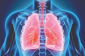 Preventing lung cancer mortality by computed tomography screening: How At Risk Pittsburghers Can Stay Ahead Of Lung Cancer Pittsburgh Magazine