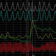 Anaheim, ca polygraph lie detector test place near me in glendale, california. Is A Polygraph A Reliable Lie Detector