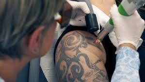 Je zult er later spijt van hebben!!!! Tattoo Art Removal Tattoo Design