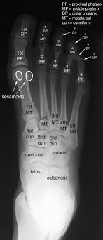 Radiographic Anatomy Of The Skeleton Foot Anteroposterior Ap View Labelled Radiology Student Medical Knowledge Anatomy