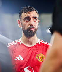 I thought Rushford is selfish but the most super selfish is Bruno at  Manchester United mxm.....