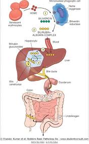 bilirubin metabolism best diagram i have ever seen for this