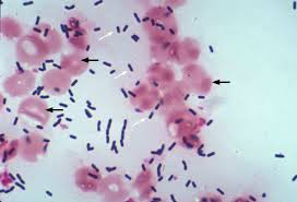 Under our experimental conditions, there were no clear associations between biofilm formation increased adhesion of listeria monocytogenes strains to abiotic surfaces under cold stress. E Coli Under Microscope Gram Stain