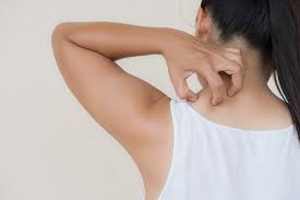 Simak di sini cara memutihkan ketiak dengan cara alami. Jamur Kulit Gejala Penyebab Dan Mengobati Alodokter