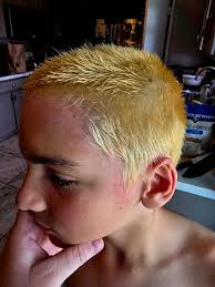 Can someone bring Benedryl to the building?