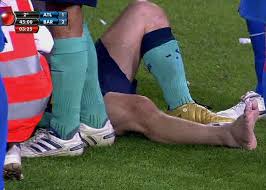 Ese tobillo hinchado se convirtió en una imagen icónica, que ahora se comparó, una vez más, con quien es el mejor homenaje a diego: Messi Sufre Una Distension Del Ligamento Lateral Interno Del Tobillo Derecho As Com