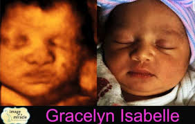 Chiropractor Of Columbus