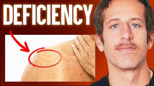 The #1 Deficiency Behind Aging! (Spot & Treat This ASAP)