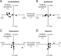 Image result for Visual Fixation