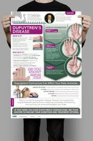 Check spelling or type a new query. 76 Dupuytren S Contracture Ideas Dupuytren S Contracture Dupuytren S Contracture Treatment Hand Surgery