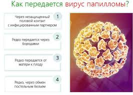 Analiz Na Virus Papillomy Cheloveka Pcr Test Na Virus Papillomy Cheloveka Surgery Senter Kiev