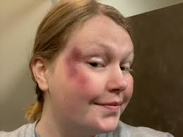 Program Director, Madeline Horne, just completed her training course,  practical exam, and written exam. She is now a certified Wilderness First  Responder. This course is offered by National Outdoor Leadership School  (NOLS) @