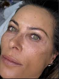 נשות גדרה יקרות❤️ חדש אצלנו בקליניקה, הרמת ריסים למראה נוצץ ומושלם. מוזמנות  ליצור קשר לתאום תור 054-9010005