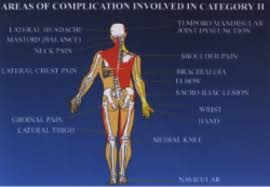 Articulated at or toward the back of the oral passage : Low Back Pain Muscle Spasm Gallery