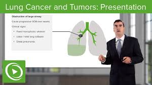 It can be due to excessive coughing or maybe the cold has a firm hold on the lungs. Lung Cancer And Tumors Presentation Respiratory Medicine Lecturio Youtube
