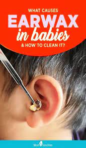 How To Clean Baby Earwax Safety And When To See A Doctor Clean Ear Wax Out Ear Cleaning Wax Ear Wax