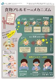 食物アレルギーのメカニズム infographics アトピー性皮膚炎 健康と美容 健康