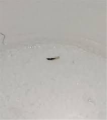 If you scratch the area, the eggs get on your fingers or under your nails, then. Transparent Worm Archives All About Worms