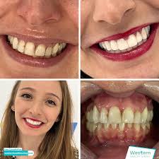 Western Health Turkey in Izmir • Read 10 Reviews