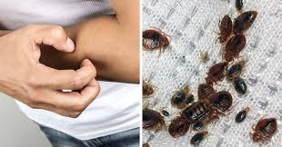 Jadi, bagaimana untuk mengelak dan hilangkan kesan gigitan nyamuk pada bayi ini?berikut adalah petua semulajadi yang selamat untuk digunakan bagi melegakan dan sekaligus hilangkan kesan. Pepijat Dan Kesan Gigitan Pepijat Cara Berkesan Hapuskan Pepijat