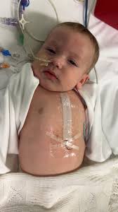 Best opener I've ever had. Andy Satterfield Andy's Army has battled birth  defects and 23 surgeries. Click