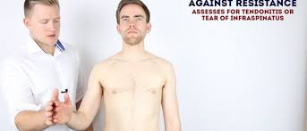 Image result for Shoulder Exam