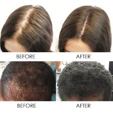Since progesterone is a precursor to testosterone, it can help inhibit dht (that tricky little devil that causes the follicles to shrink) and stop more loss from occurring. Hair Tonic Location Riyadh Wellness And Hrt Products Facebook