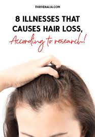 8 Illnesses That Cause Hair Loss Based On Research Thrivenaija Hair Loss Severe Hair Fall Androgenetic Alopecia