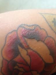 A tattoo breaks the skin, so infection, inflammation inflammation sometimes manifests as small, painless bumps called granulomas. Itchy Rash On Old Tattoo 2020