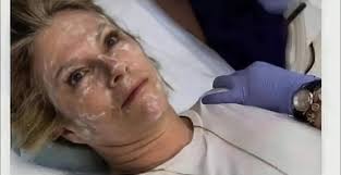 When you're waiting for him to bring you a towel and you hear his car start  instead…