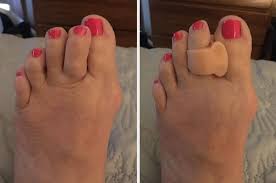 If you have stairs, trip and fall down them, twisting the ankle. 36 Things You Need If You Re Broke But Want Fast Results