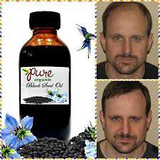 Black seeds are quite well known for their beneficial effects on human health. Premium Organic Black Seed Oil Natural Remedies And Black Seed Oil Black Seed Oil Benefits Organic Black Seed Oil