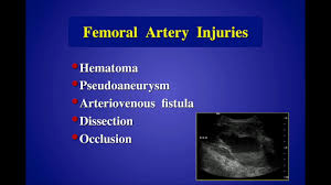 Image result for Pseudoeriosema