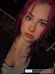 Ankylosing Spondylitis