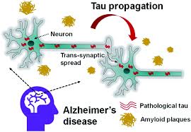Maybe you would like to learn more about one of these? Clinically Oriented Alzheimer S Biosensors Expanding The Horizons Towards Point Of Care Diagnostics And Beyond Rsc Advances Rsc Publishing